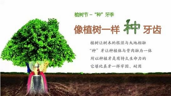 <b>植树节“种牙季”： 赶紧带上父母做种植牙吧</b>