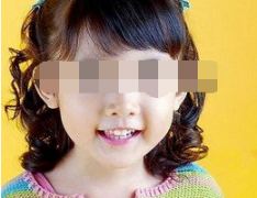 福州儿童乳牙滞留会引起牙错位