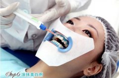 福州如何预防牙齿变黄?