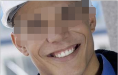 龅牙给人带来的一些痛苦
