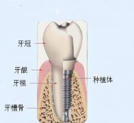 老人牙齿修复的优势