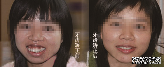 C:\Users\Administrator\Desktop\1_100822094511_1.jpg