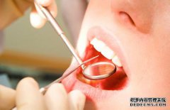 刷牙不彻底易导致牙周炎