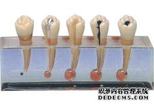 牙髓炎的形成原因有哪些