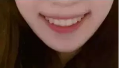 牙齿不齐有哪些治疗方法