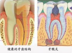 牙齿疼痛怎么办