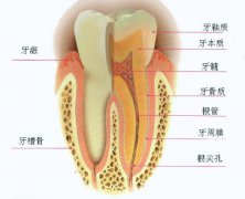 福州慢性牙髓炎怎么办？