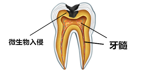 牙髓会受到哪些外来环境影响