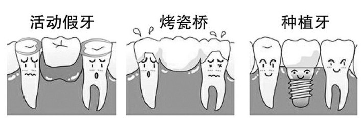 种植牙