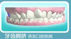 牙齿拥挤矫正的价格是多少