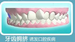 昆山城北牙齿拥挤矫正的价格是多少