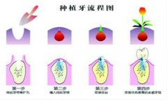 缺牙问题的原因以及解决方案
