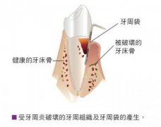 门牙缺失后，六种“后遗症”被留了下来