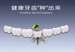 牙齿缺失做种植牙效果好