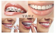 牙齿不齐的情况是怎么发生的呢