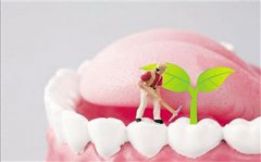 长期缺牙是不是做种植牙比较好