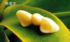 全瓷牙可以修复牙齿缝隙变大吗