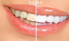 是什么造成牙齿变色的问题呢