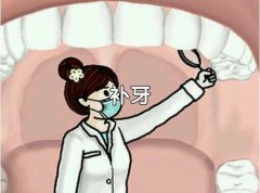 拔牙如果处理不当会有哪些危害