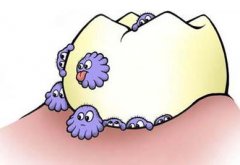 怎样预防门牙蛀牙的问题