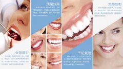 福州矫正龅牙要多少钱