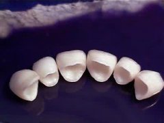 美牙冠到底疼不疼痛呢