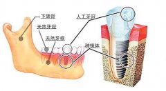 <b>牙掉了没口福?没事，还有人类第三副牙齿</b>