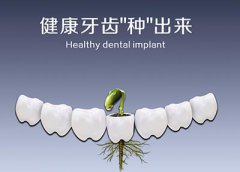 前牙缺失怎么修复