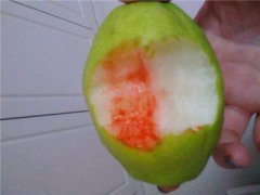 多年的牙龈出血如何治愈？