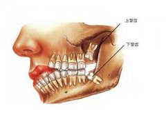 哪些智齿不用担心要拔牙呢