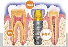 后牙缺失有什么危害