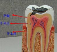 在什么情况下需要做根管治疗