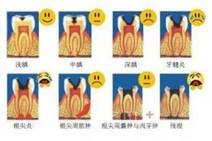 如何预防和治疗龋齿？