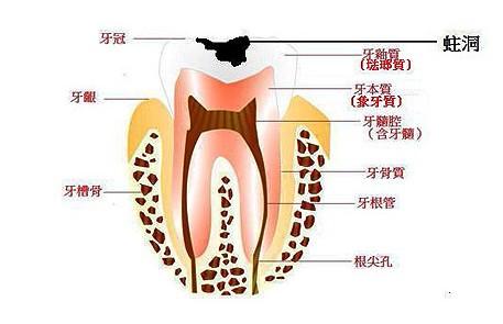 儿童发生龋病的原因？