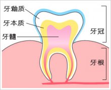 急性牙髓炎治疗要多少钱呢？