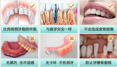 <b>即刻种植牙有什么优势</b>
