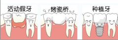 牙齿掉了怎么办