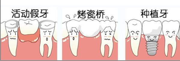牙齿掉了怎么办