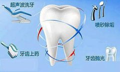 喷砂洁牙和超声洁牙有什么区别