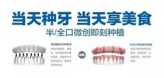 <b>年前快速种牙，为何大家青睐这项技术？</b>